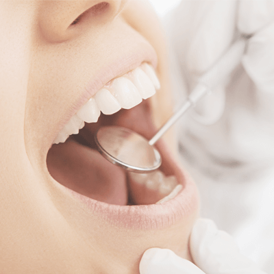 痛みの少ない虫歯治療