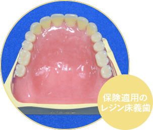 レジン床義歯