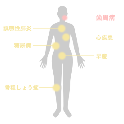 歯周病を全身疾患のかかわり