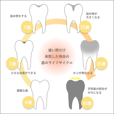 歯のライフサイクル