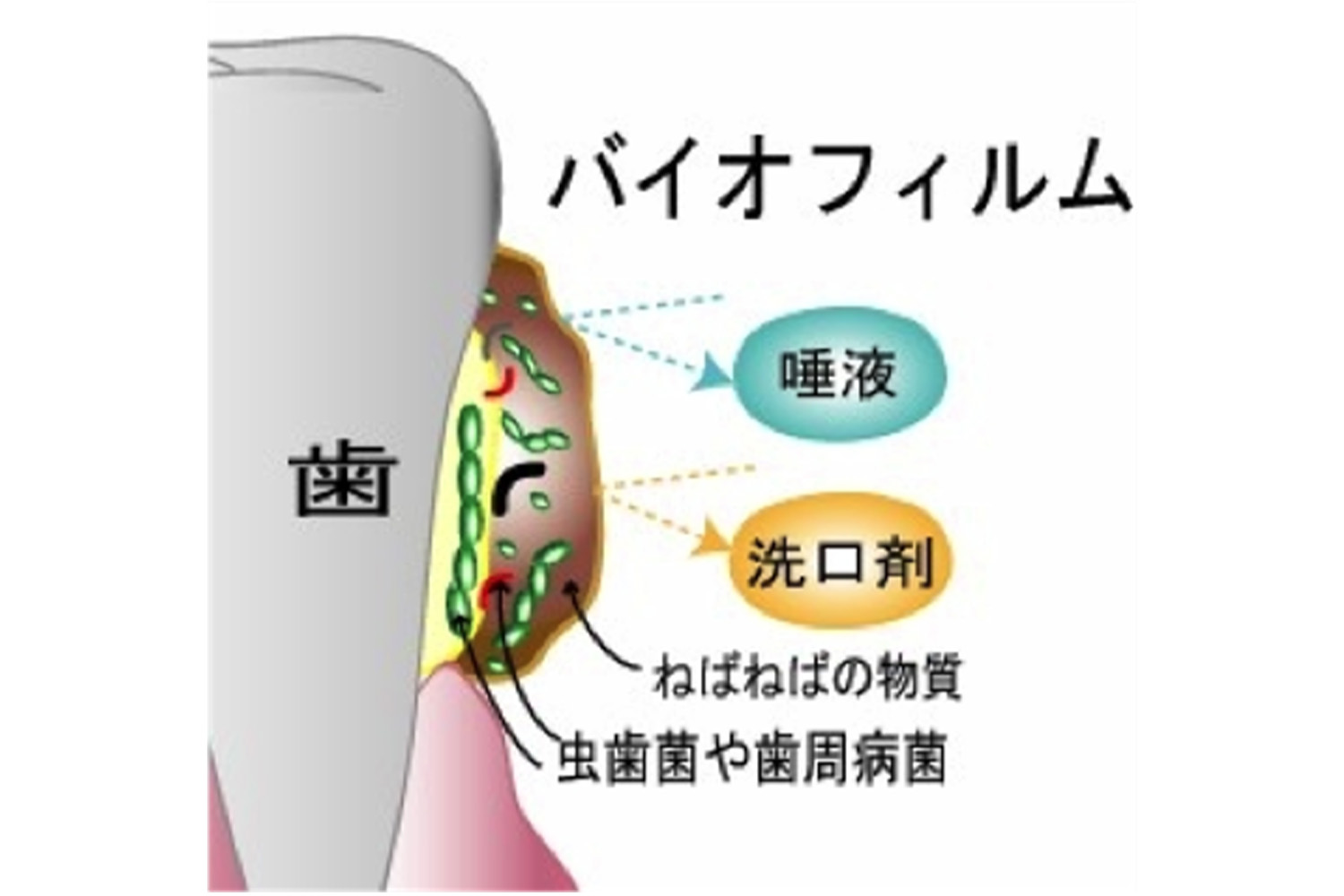 プラーク（歯垢）とは